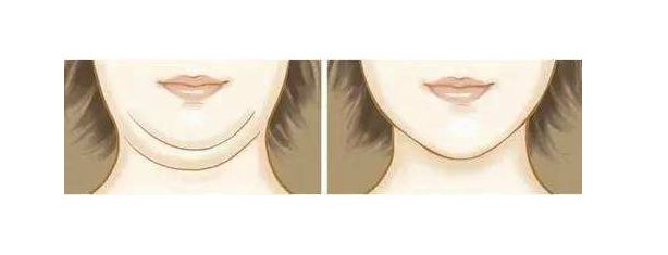 如何消除双下巴？三种方法让你的下巴恢复紧致.jpg