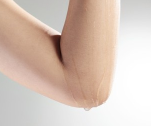 手肘肌肤如何快速美白 细节护肤