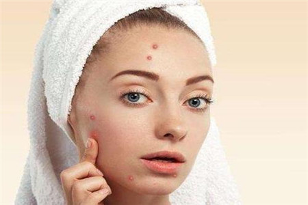 25岁女人引起脸颊两边长痘痘的原因