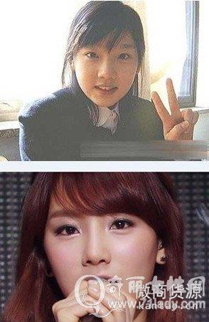 少女时代金泰妍整容了吗？金泰妍整容前后对比照