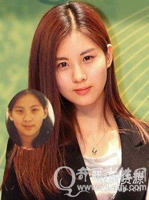 少女时代徐贤整容了吗?徐贤整容前后对比照片