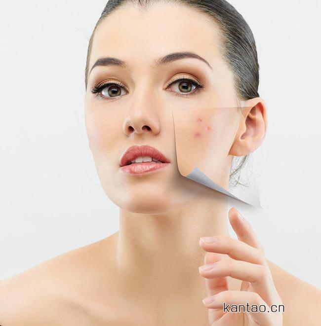 怎样去除脸上的疤印 祛疤心中有数让肌肤恢复如初